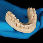 Formlabs - Form 4 BEGO™ VarseoSmileⓇ TriniQⓇ Resin A3 Resin 750g